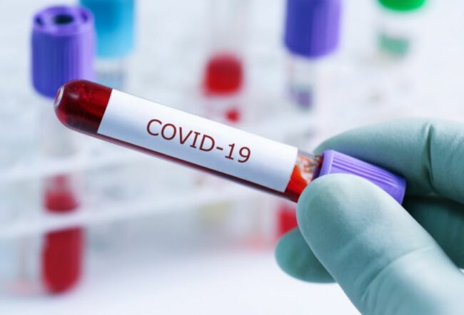 COVID-CORONAVIRUS-ARCHIVIO-ARKIV-27-650x442