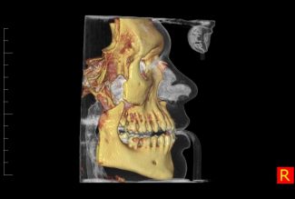 dental-scan