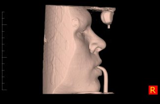 dental-scan2-325x213