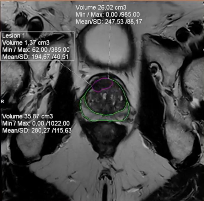 Alfonso-Fausto-8-min-1-650x642