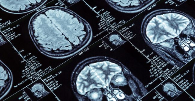 Risonanza-Magnetica-Encefalo-e-Tronco-Encefalico-Medical-Group-Formato-Mobile